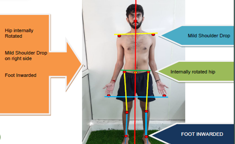 Postural Analysis