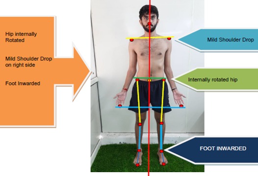 BIO-MECHANICAL & KINETIC CHAIN ANALYSIS